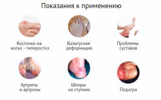 Эффективность применения геля Valgusteen от шишки на ноге для улучшения здоровья