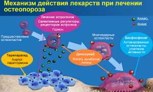 Бисфосфонаты для успешного лечения остеопороза: эффективность и рекомендации
