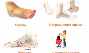 Как лечить боли стопы после сна при наступании? Полезные советы и рекомендации