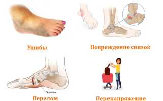 Как лечить боли стопы после сна при наступании? Полезные советы и рекомендации