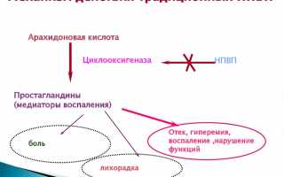 Как лечить межреберную невралгию в домашних условиях эффективно?