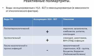 Лечение полиартрита коленного сустава: методы и рекомендации