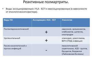 Лечение полиартрита коленного сустава: методы и рекомендации