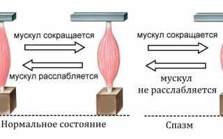 Почему возникает мышечный спазм в спине и как его устранить? Полезные советы