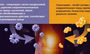 Препараты Хондрозамин и Хондрозамин Нео для лечения суставов: особенности и преимущества