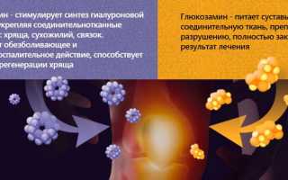 Эффективен ли Артрофлекс при заболеваниях суставов? Узнайте мнение специалистов