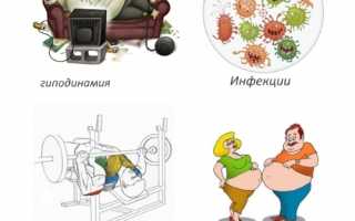 Что такое шейный остеохондроз и как его лечить? Полезные советы и рекомендации
