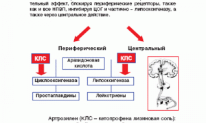 Как применять ректальные суппозитории Кетонал для облегчения боли?