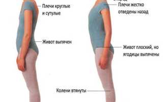 Почему появляется сутулость и как от нее избавиться? Полезные советы