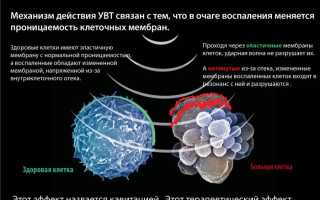 Лечение межпозвоночной грыжи ударно-волновой терапией: эффективные методы и рекомендации
