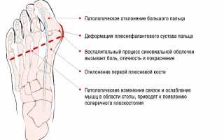 Лазерный метод удаления шишек на ногах: эффективное решение проблемы