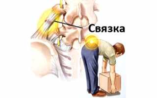 Лечение растяжения мышц спины в домашних условиях: советы и рекомендации
