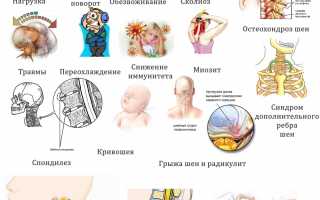 Чем могут быть вызваны боли в области шеи справа? Узнайте причины и советы