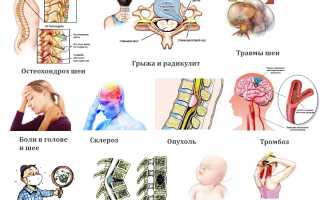 Что показывает магнитно–резонансная томография шеи? Узнайте важные детали.