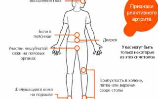 Что такое артрит суставов и почему возникает эта болезнь? Узнайте больше о причинах