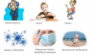 Симптомы и лечение ювенильного ревматоидного артрита у детей