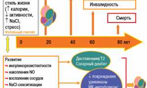 Группы инвалидности при подагре и порядок ее оформления для пациентов