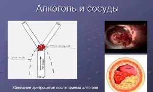 Почему после употребления алкоголя болят ноги и что с этим делать для облегчения?