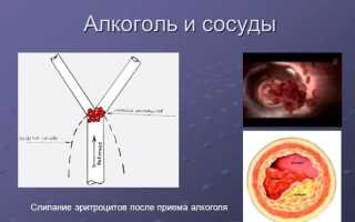 Почему после употребления алкоголя болят ноги и что с этим делать для облегчения?