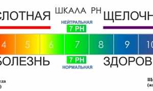Особенности лечения суставов с помощью пищевой соды в домашних условиях