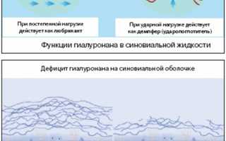 Применение уколов Гиларт для лечения суставов: эффективность и рекомендации