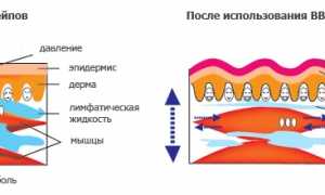 Правильное проведение тейпирования коленного сустава для эффективной реабилитации