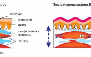 Правильное проведение тейпирования коленного сустава для эффективной реабилитации