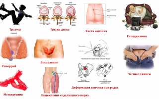 Проведение ультразвукового исследования копчика для диагностики заболеваний