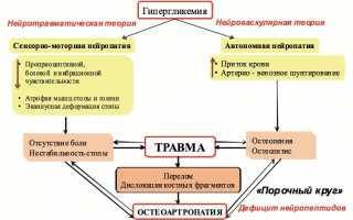 Диагностика сустава Шарко и лечебные мероприятия для восстановления здоровья