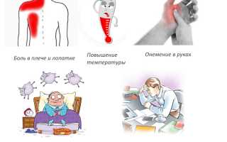 Препараты для лечения плечелопаточного периартрита: эффективные методы и рекомендации