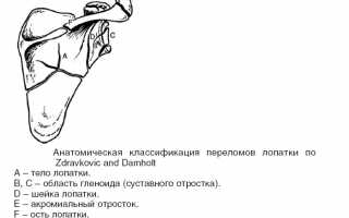 Признаки и способы лечения перелома лопатки у взрослых