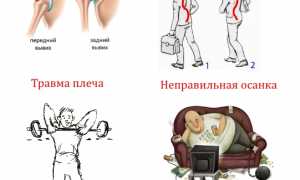 Почему болит плечо при отведении руки назад? Узнайте причины и решения
