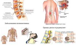 Какие упражнения помогают при болях в пояснице? Полезные советы и рекомендации