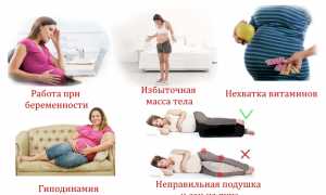 Почему возникает онемение рук у беременной женщины? Причины и рекомендации