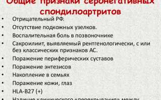 Симптомы и методы лечения серонегативного спондилоартрита у пациентов
