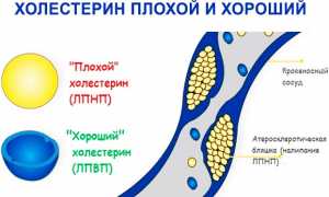 Как правильно лечить суставы с помощью гусиного жира? Полезные советы и рекомендации
