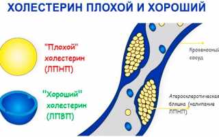 Как правильно лечить суставы с помощью гусиного жира? Полезные советы и рекомендации