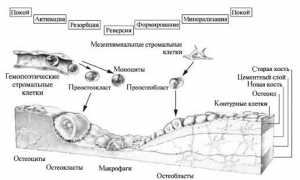 Эффективные уколы при остеопорозе для улучшения здоровья