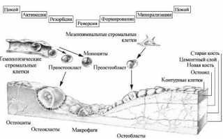 Эффективные уколы при остеопорозе для улучшения здоровья