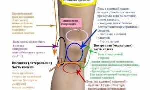 Появление боли под коленом и способы ее устранения: причины и рекомендации