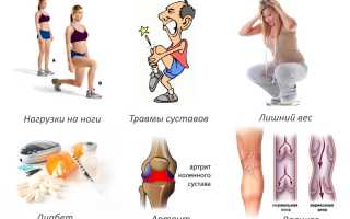 Деформирующий артроз коленного сустава 1 степени: причины и лечение