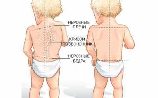 Причины боли в спине у ребенка и способы ее устранения: советы для родителей