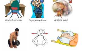 Что делать при растяжении связок и мышц шеи? Полезные советы и рекомендации.
