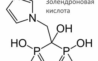 Когда необходимо принимать Золедроновую кислоту для здоровья?