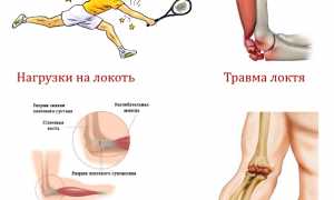 Как снять боли в локте при сгибании и разгибании? Полезные советы и рекомендации