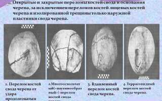 Виды, лечение и последствия перелома основания черепа: важная информация для пациентов