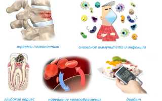 Причины возникновения остеомиелита позвоночника и его лечение: важные аспекты