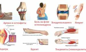 Ультразвуковое исследование локтевого сустава: особенности и преимущества