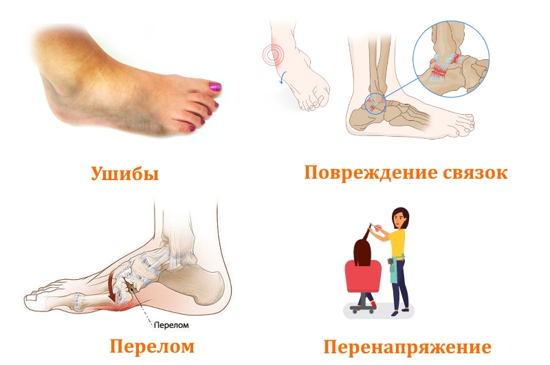 Боли в ступнях вследствие травм
