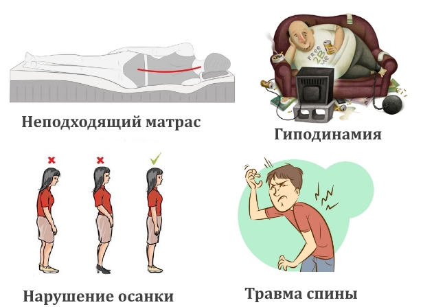 Бытовые причины боли в спине